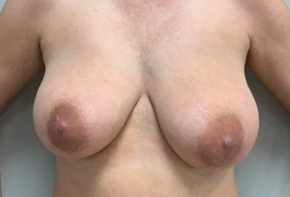 Before image