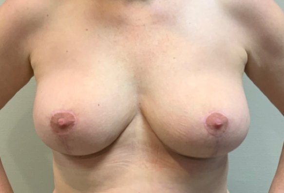 After image