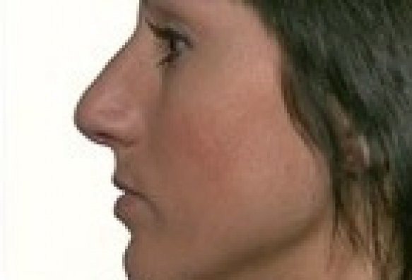 After image