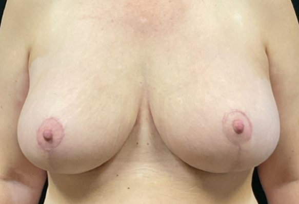 After image