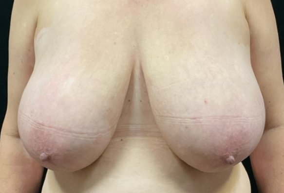 Before image