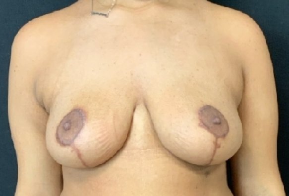 After image