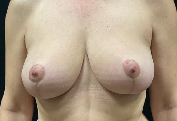 After image