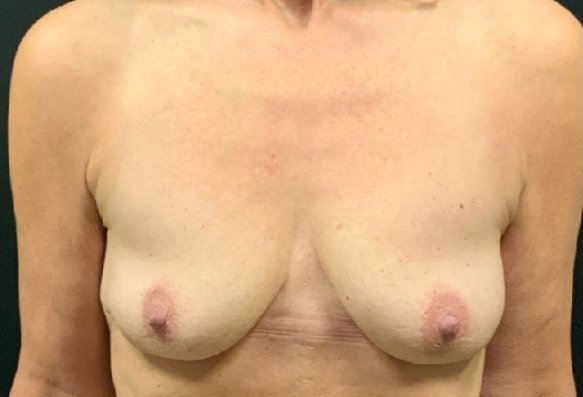 After image