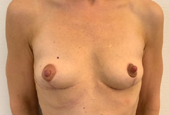 After image