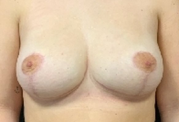 After image