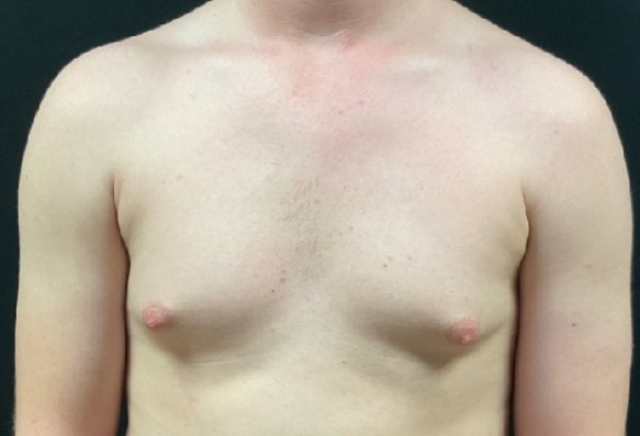 Before image