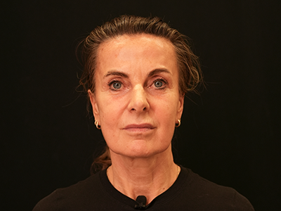 Before: Facelift