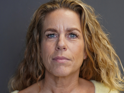 Before: Botulinetoxine